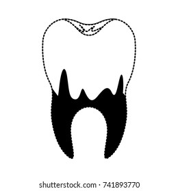 caries in the root of tooth in black dotted silhouette vector illustration