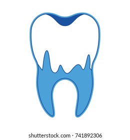 caries in the root of tooth in blue silhouette vector illustration