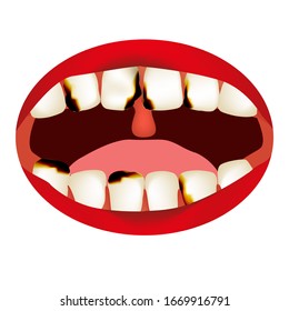 caries. Smell from the mouth. Halitosis. The structure of the teeth and oral cavity. Diseases of the teeth caries. Infographics. Vector illustration on isolated background.