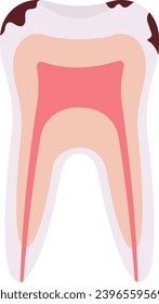 Ilustración del vector de problemas de dientes de Caries