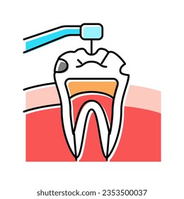 caries treatment color icon vector. caries treatment sign. isolated symbol illustration