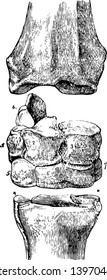 Carpus of a Horse the uppermost bone is the distal end of the radius vintage line drawing or engraving illustration.