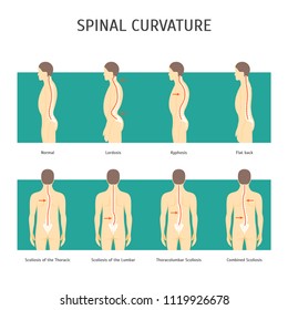 Cartoon Back with Scoliosis Card Poster Spine Human Health Care Concept Element Flat Design Style. Vector illustration