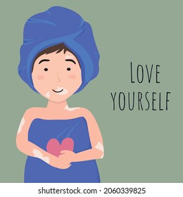 Cartoon Beautiful Girl with Vitiligo wrapped in a blue towel after taking, Love Yourself. Vector illustration Cartoon style