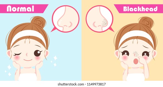 cartoon beauty woman with blackhead problem on nose before and after