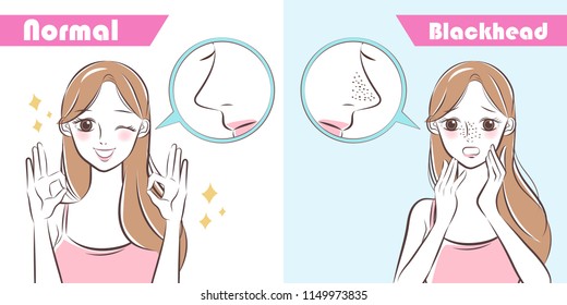 Cartoon Beauty Woman With Blackhead Problem On Nose Before And After