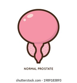 Cartoon Benign And Prostate Vector Illustration. Icon Character Of Male Urology Inflammation Disease. Flat Design For Diagram, Medical Journal Article. Prostatitis, Enlarged,obstruction,hypertrophy