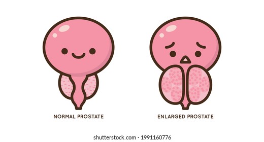 Cartoon Benign And Prostate Vector Illustration. Icon Character Of Male Urology Inflammation Disease. Flat Design For Diagram, Medical Journal Article. Prostatitis, Enlarged,obstruction,hypertrophy