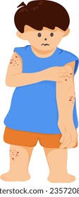 Zeichnen eines Cartoons mit Juckreiz und Rötung, Allergie der Kinder, Allergiesymptome, Dermatitis, Vektorgrafik.