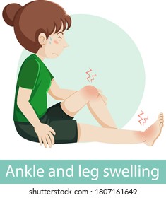 Cartoon Character With Ankle And Leg Swelling Symptoms Illustration