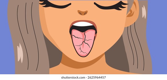 Cartoon close-up of a woman showing a fissured tongue vector illustration. Drawing for health, anatomy and wellness designs