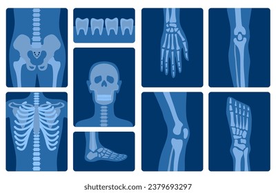 Cartoon Color Xray Shots Human Skeleton Body Parts Set. Vector illustration of Roentgen Head, Bones, Foot and Hand