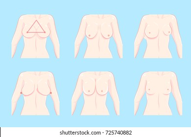 cartoon different chest shape on the blue background