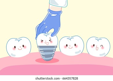 cartoon doctor hand is picking tooth implant