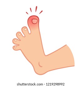 Cartoon foot with swollen stubbed toe, pain and trauma vector illustration.