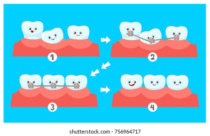 Cartoon Funny Teeth Without Dental Braces and After Correction With Brackets. Vector Illustration