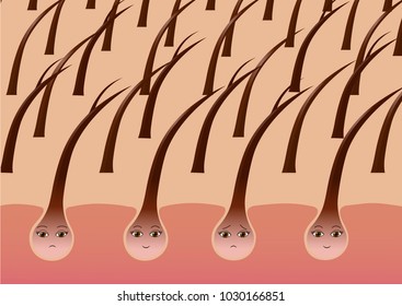 Cartoon hair follicles on the scalp suffering from split ends