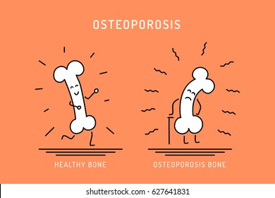 Cartoon of healthy bone and bone affected by osteoporosis