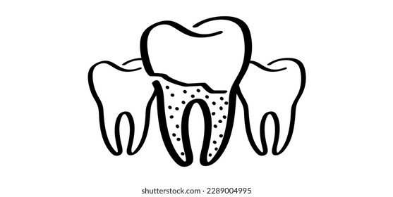 Cartoon healthy, tooth with gums, line pattern. Vector drawing silhouette icon. Damage teeth or tooth with caries. Cracked tooth, mouth and dental, damaged. Strong enamel, disease.