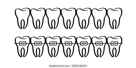 Caricatura sana, diente con encías. Patrón de línea molar. Icono de silueta de dibujo vectorial. Daño de dientes o dientes con caries. Diente agrietado, boca y odontología, dañado. Esmalte fuerte, enfermedad.