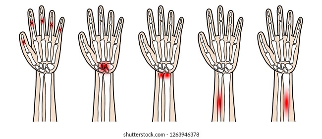 Cartoon illustration of arms with injuries,Hand drawn,Vector,Illustration,Doodle.