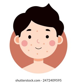 A cartoon illustration of a boy with acne on his face and a smile