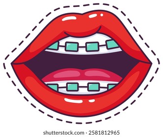 Cartoon illustration featuring vibrant red female lips adorned with braces and a visible tongue, highlighting the importance of dental care and orthodontic treatment for oral health