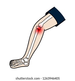 Cartoon illustration of a leg with a knee injury,Hand drawn,Vector,Illustration,Doodle.