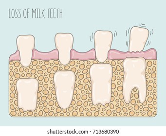 Cartoon illustration showing how loss milk teeth and new teeth grow