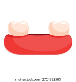 Ilustração em desenho animado de dois dentes ligados a gengivas vermelhas mostrando diastema dentário