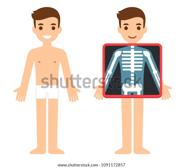 漫画の男性キャラクターがx線検査を受ける 胸の骨を表す透明な画面 X線写真の試験イラスト 健康科学のベクター画像クリップアート のベクター画像素材 ロイヤリティフリー