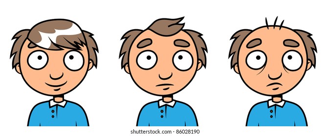 Cartoon man balding process, vector illustration