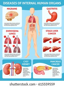 Cartoon medical care infographic concept with different diseases of internal human organs vector illustration