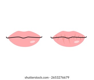 Desenho animado médico mostrando uma boca saudável e lábios rachados secos que precisam de ilustração de vetor de hidratação