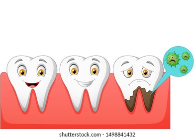 Cartoon normal and unhealthy tooth. vector illustration