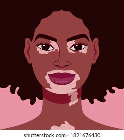 Cartoon portrait of young beautiful black woman with patches of vitiligo on the skin