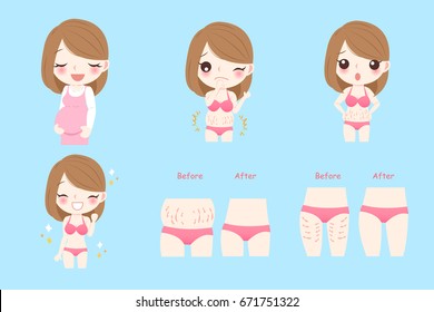 Cartoon pregnant woman with stretch marks concept before and after