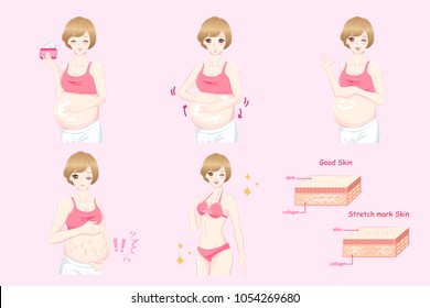 cartoon pregnant women with stretch marks on the pink background