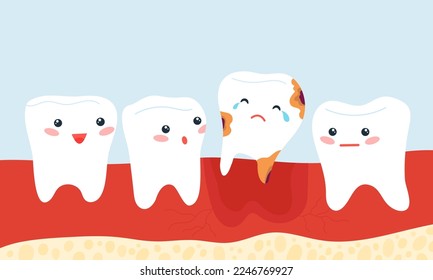 Cartoon sick tooth with caries falls out. Dentistry, pediatric stomatology banner for children. Dental health, vector teeth mascot disease and treatment