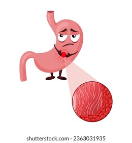 Cartoon stomach character with gastritis, inflammation in mucosa layer under magnification. Vector illustration on white background
