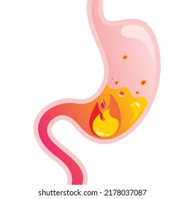 stomach cartoon