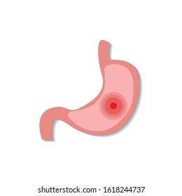 Cartoon stomach illustrations for doctors.
