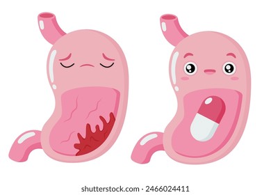 Cartoon stomach. Stomach tumor. Pills and medicines.Healthy and sick stomach character. Gastritis heartburn. Improper diet, acid, infection. Stock vector illustration isolated on white background.