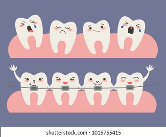 Cartoon Teeth With Braces On Blue Background. Vector Illustration.