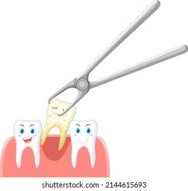 Cartoon teeth extraction on white background illustration