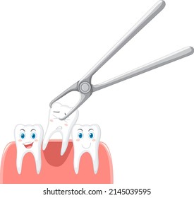 Cartoon teeth extraction on white background illustration