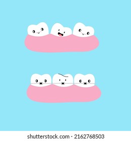 Cartoon Teeth in gum. Straight and crooked teeth. Braces before and after orthodontic treatment. Dental clinic comic mascot, vector isolated characters