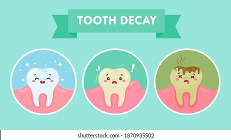 Cartoon teeth and gums inside the mouth are happy with the problem of tooth decay. There are plaque on the teeth.