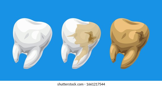 cartoon teeth healthy and caries