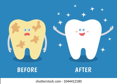 Cartoon tooth before and after cleaning or whitening or dental procedures. Dental illustration for kids. Comparison concept. Dirty and clean teeth. Flat style.